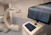 Aorta e vasi in 3D grazie al “super scanner” che si sposta da solo in sala operatoria